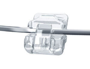 Damon Brackets