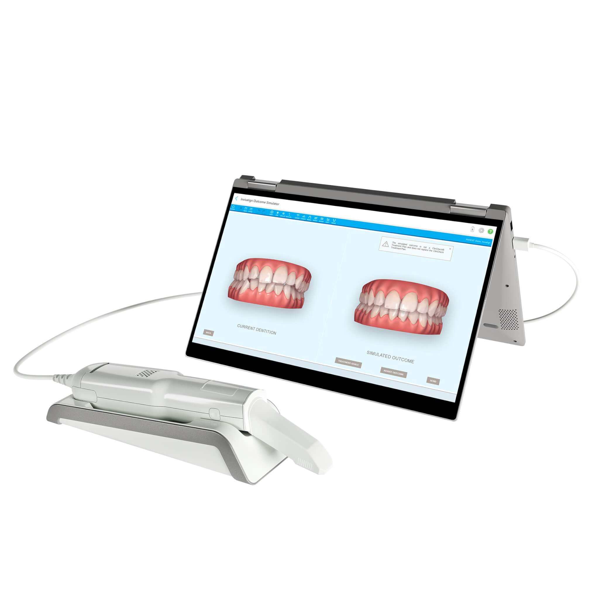 Kieferorthopäden in Essen Scan Simulation bei der Behandlung iTero ElementFlex
